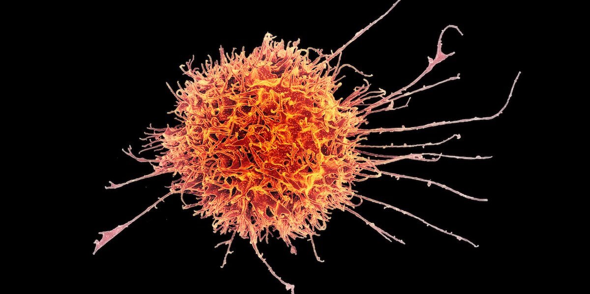 “对抗COVID-19等病毒感染的“自然杀伤细胞”获得美国国家科学基金会资助”的特色图片