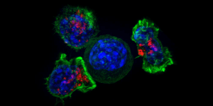 杀伤t细胞包围癌细胞。图片/美国国立卫生研究院国家儿童健康和人类发展研究所