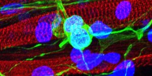 运动神经元(绿色)生长在骨骼肌(红色)的顶部。蓝色斑点显示的是细胞核。图片来源:南加州大学生命系统工程实验室